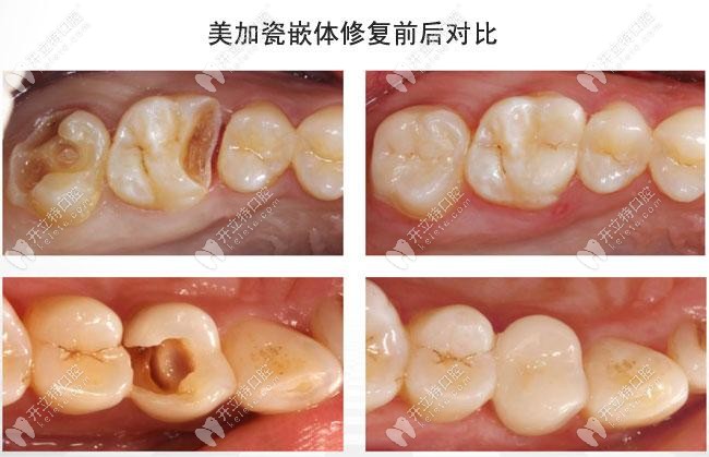 宝威体育下载网站：宝威体育官网：宝威体育：天津牙齿美容修复