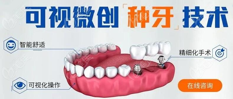 韩国植牙最新技术