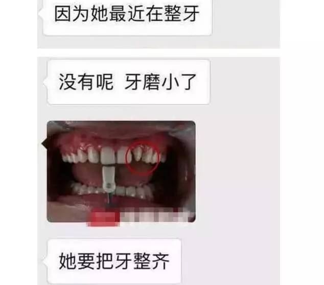 宝威体育：整牙是变美还是变残明星集体整牙为哪般？(图4)